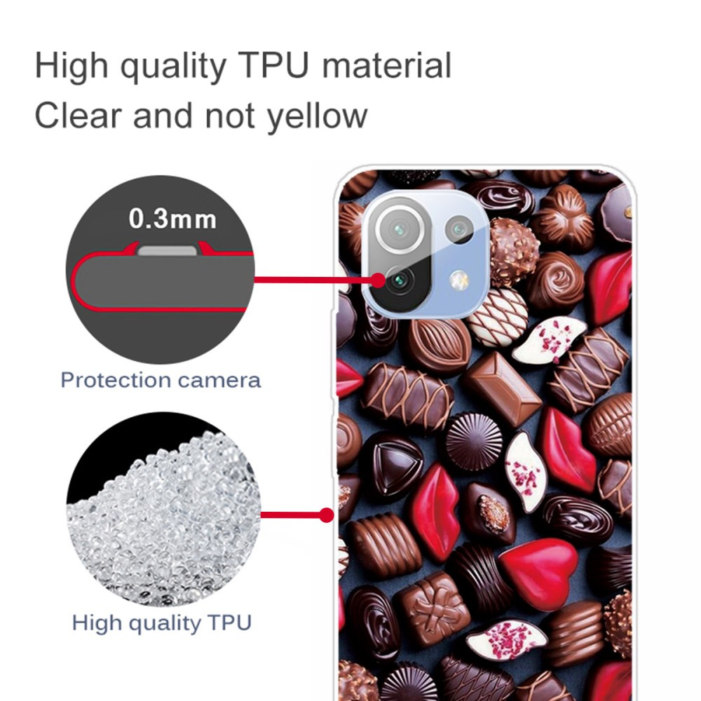 XIAOMI MI 11 LITE/5G NE Tracy nugarėlė Sweets 3