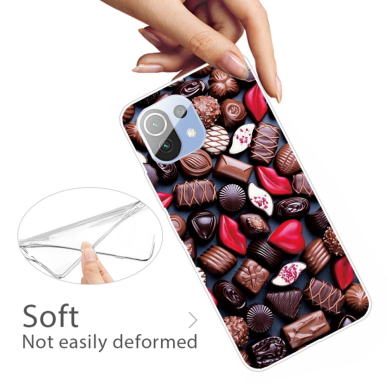 XIAOMI MI 11 LITE/5G NE Tracy nugarėlė Sweets 2